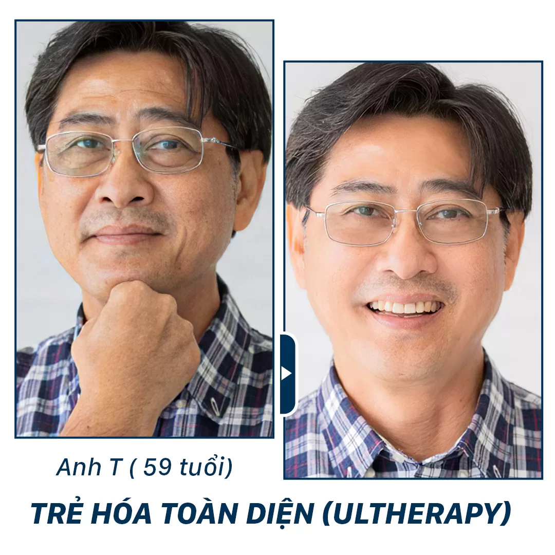 trẻ hoá aura clinic