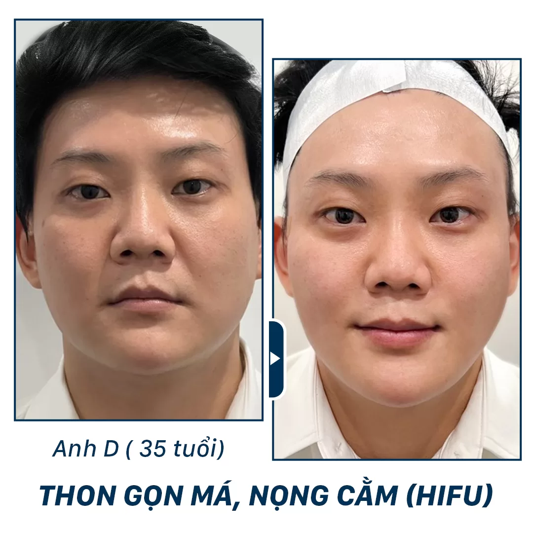 trẻ hoá aura clinic
