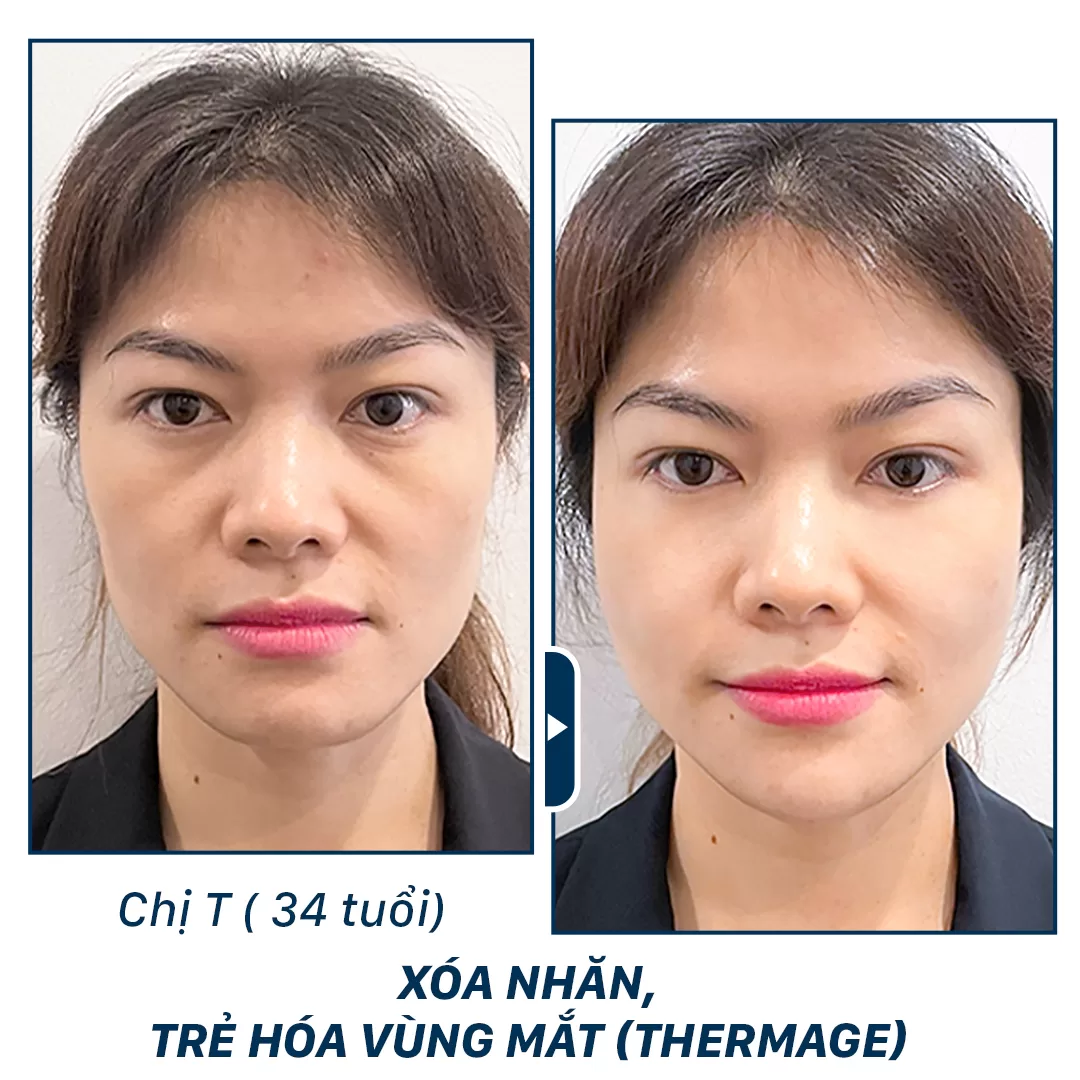 trẻ hoá aura clinic