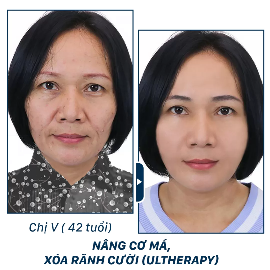 trẻ hoá aura clinic