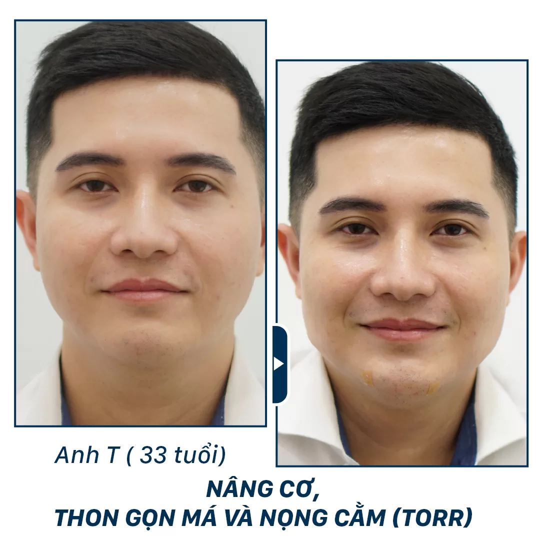 trẻ hoá công nghệ cao Aura Clinic