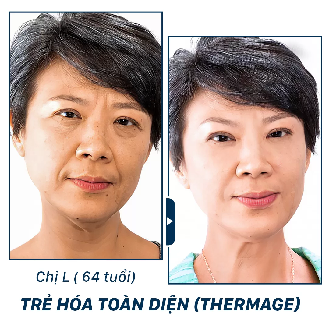 trẻ hoá công nghệ cao Aura Clinic