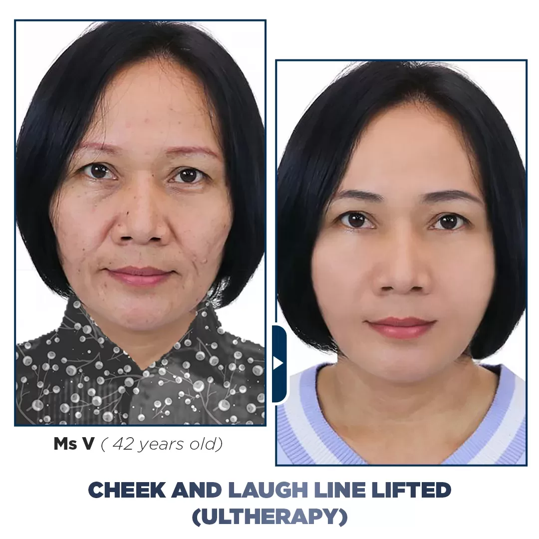 Hon-5.400-khach-hang-da-thanh-cong-4-jpg