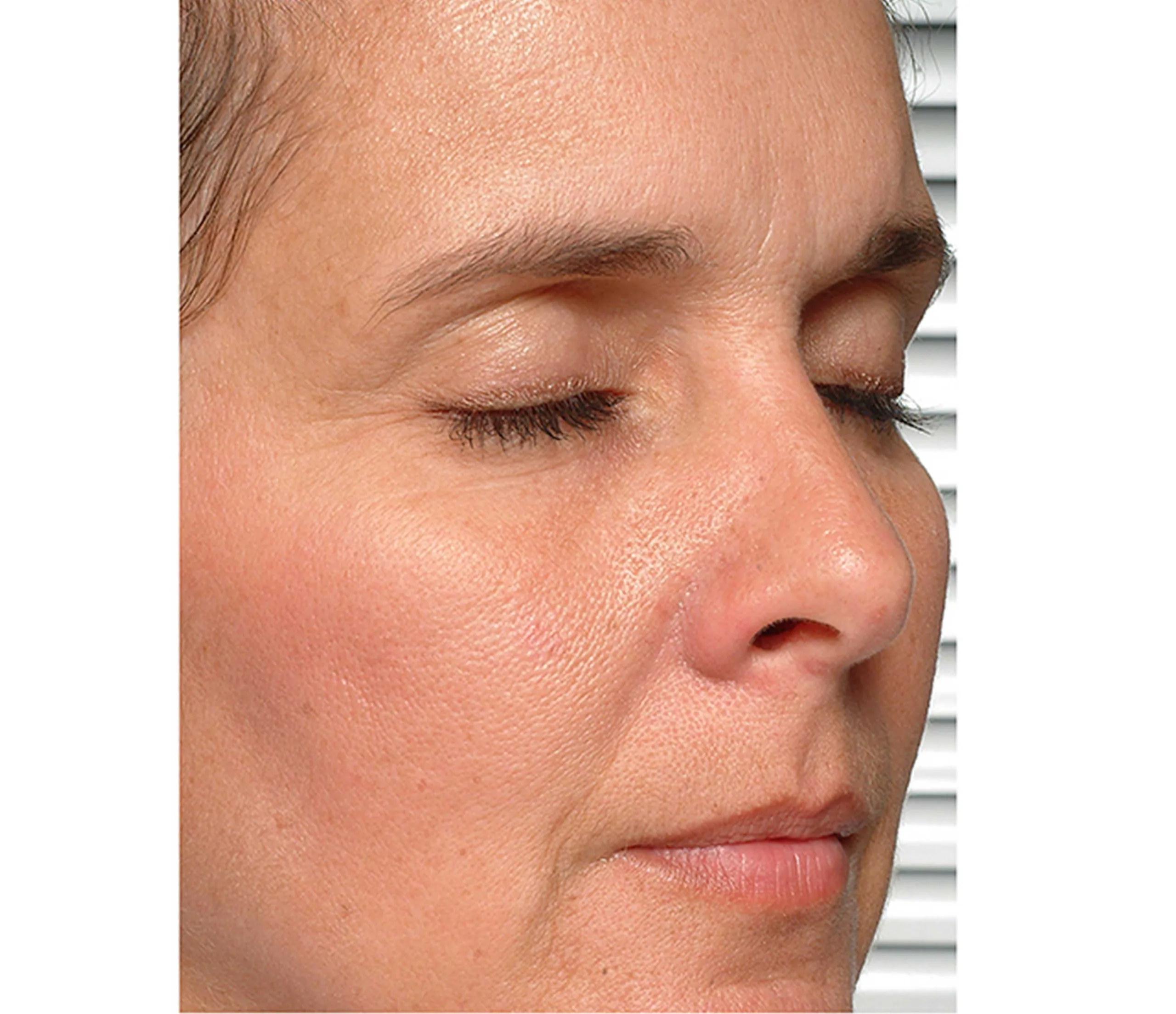 Before result image