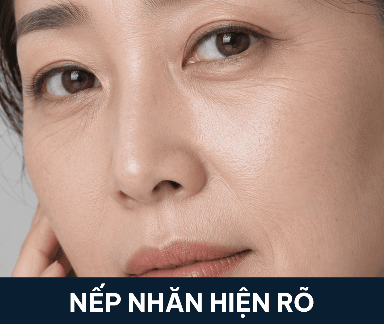 nếp nhăn hiện rõ