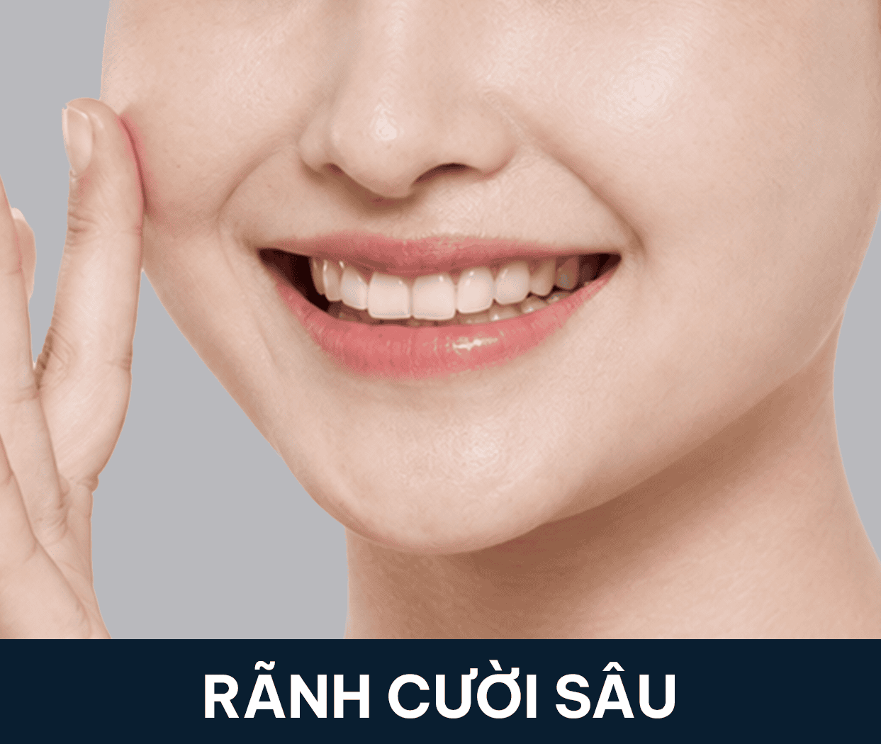 rãnh cười sâu